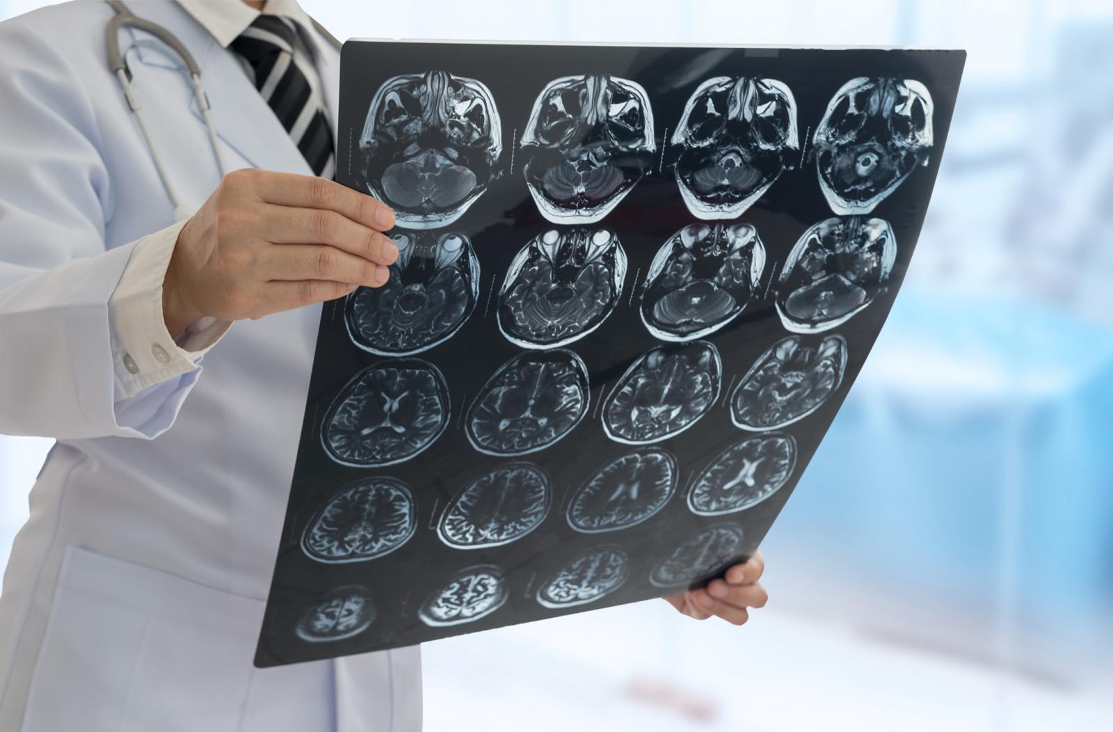 Liječenje pacijenata podignuto je na veću razinu.