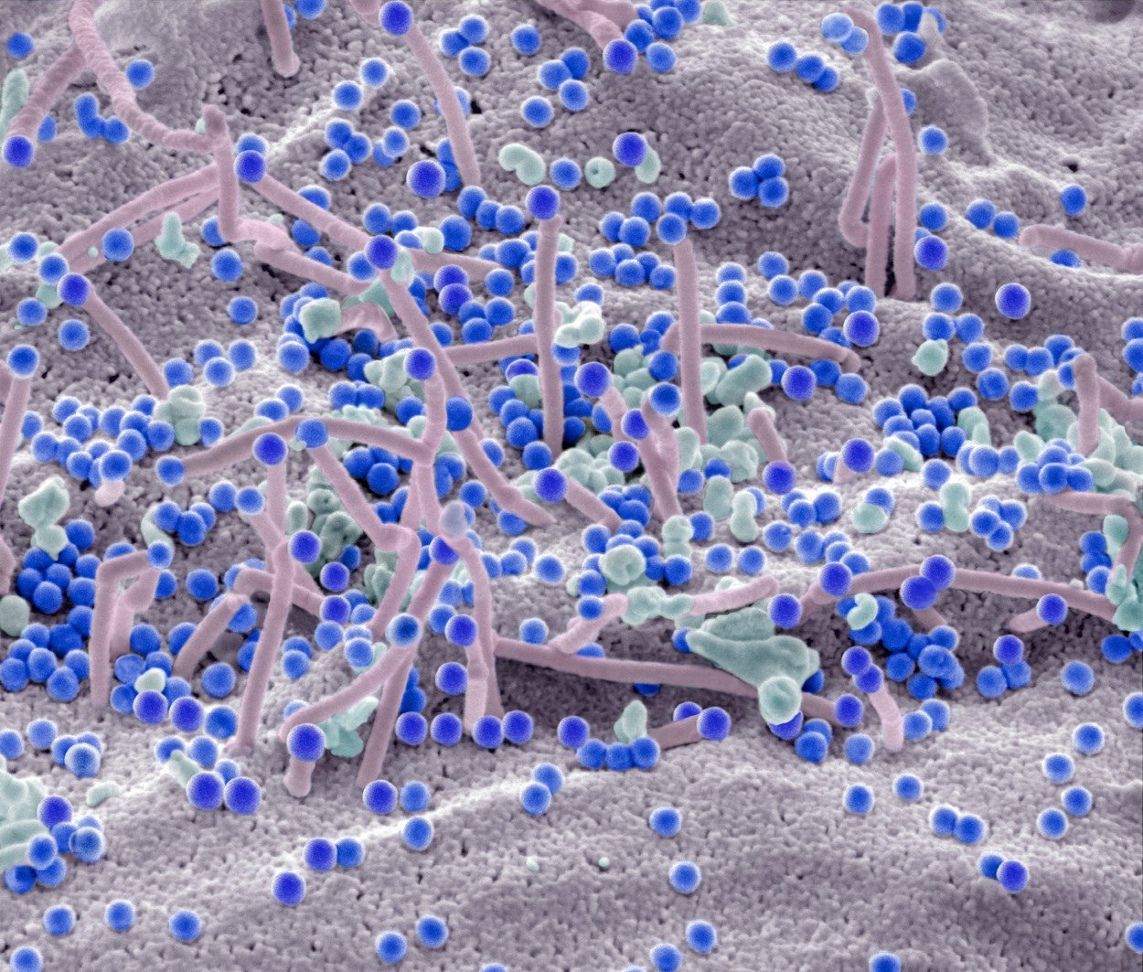 Stanice zaražene HIV-om