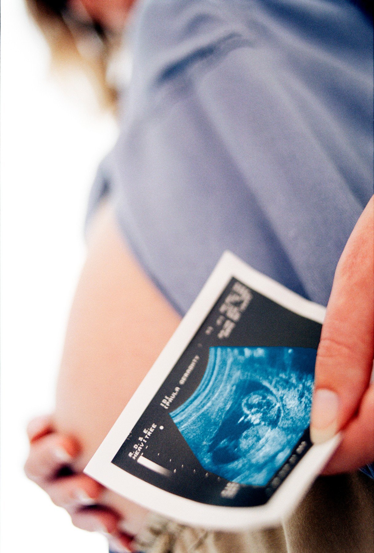 profimedia-0102356961