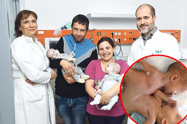 Doc. dr. Ruža Grizelj, Tambolaš Petar i Marija koji drže na rukama svoje četveromjesečne kćerke i dr. Danko Mikulić.