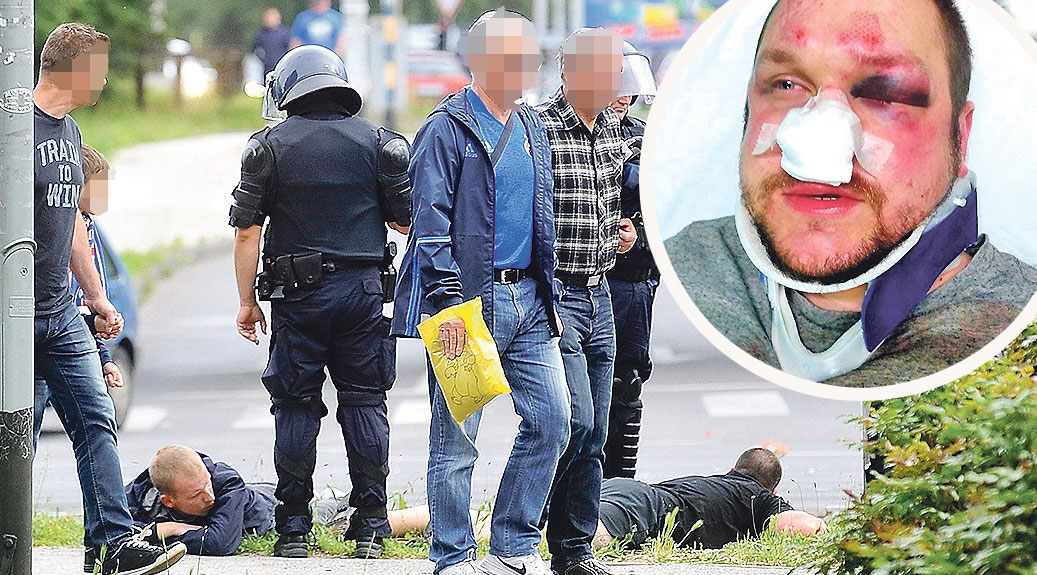 Zbog vještačenja tragova policija je uhićenim navijačima izuzela odjeću i obuću