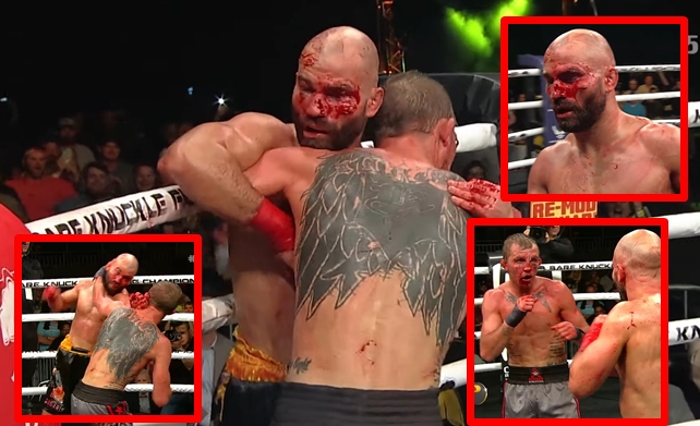 Artem Lobov vs Jason Knight BKFC 5
