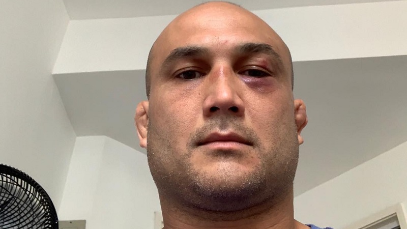 B.J. Penn