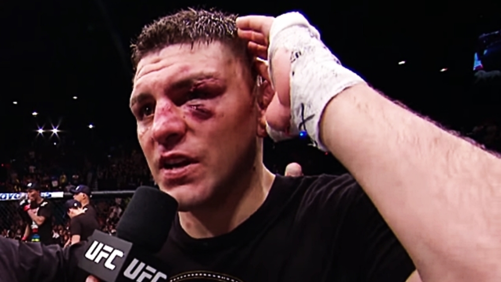 Nick Diaz