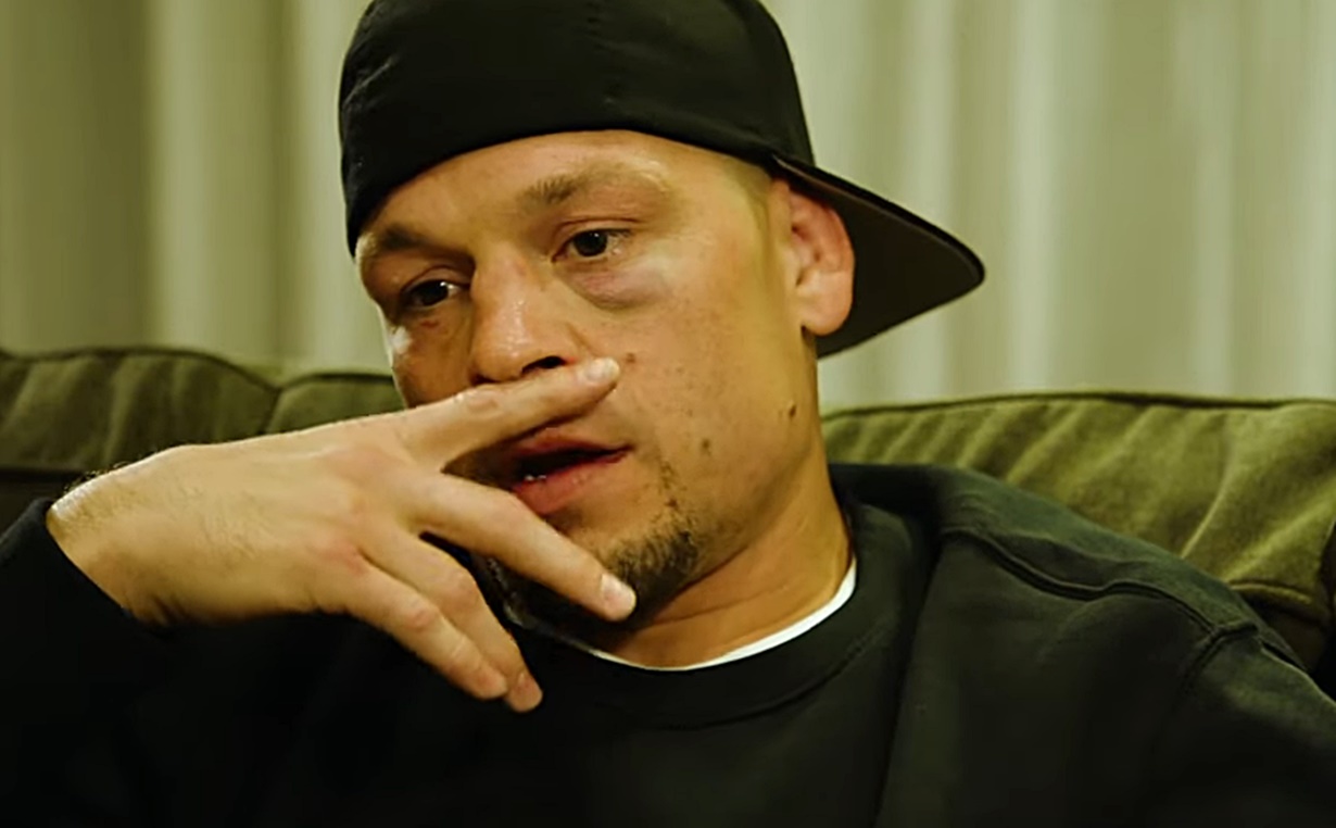 Nate Diaz