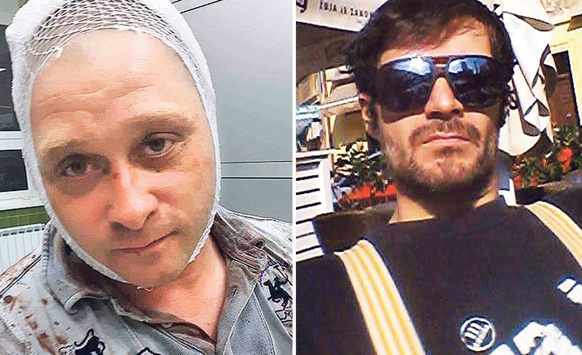 Napadnuti Richard Presečan (lijevo), Dušan Ožegović (desno)