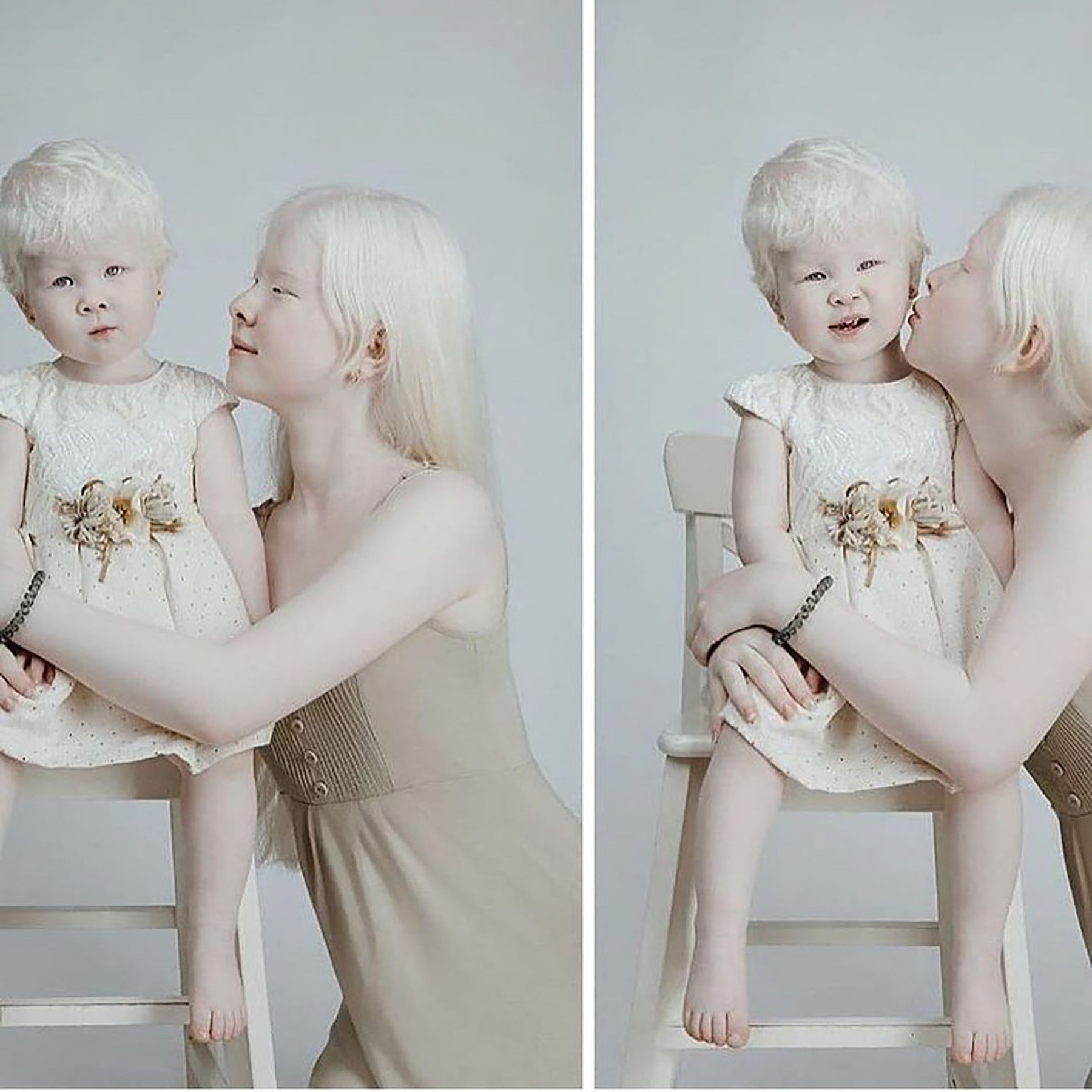albino girls1