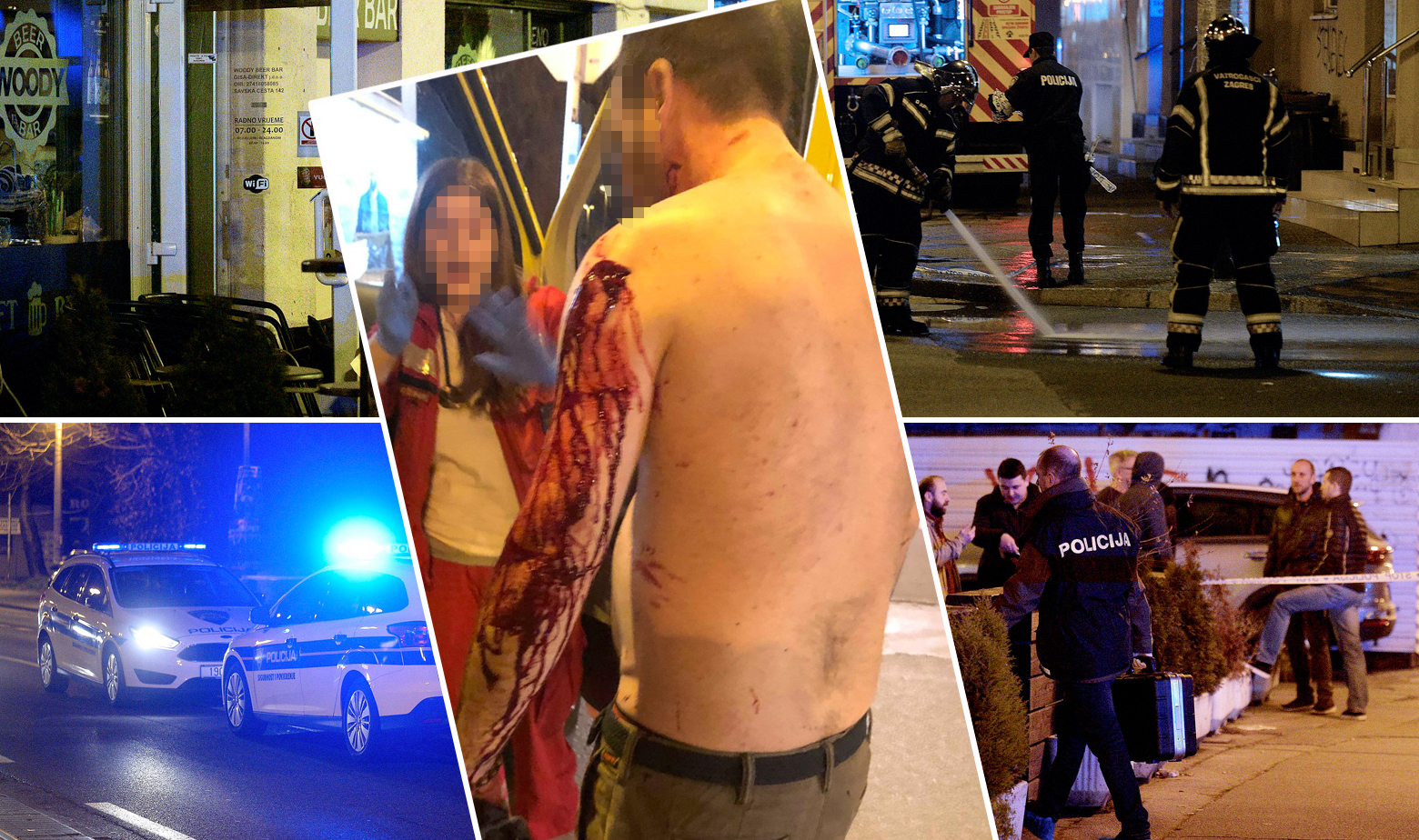 Ozlijeđeni u okršaju u Savskoj