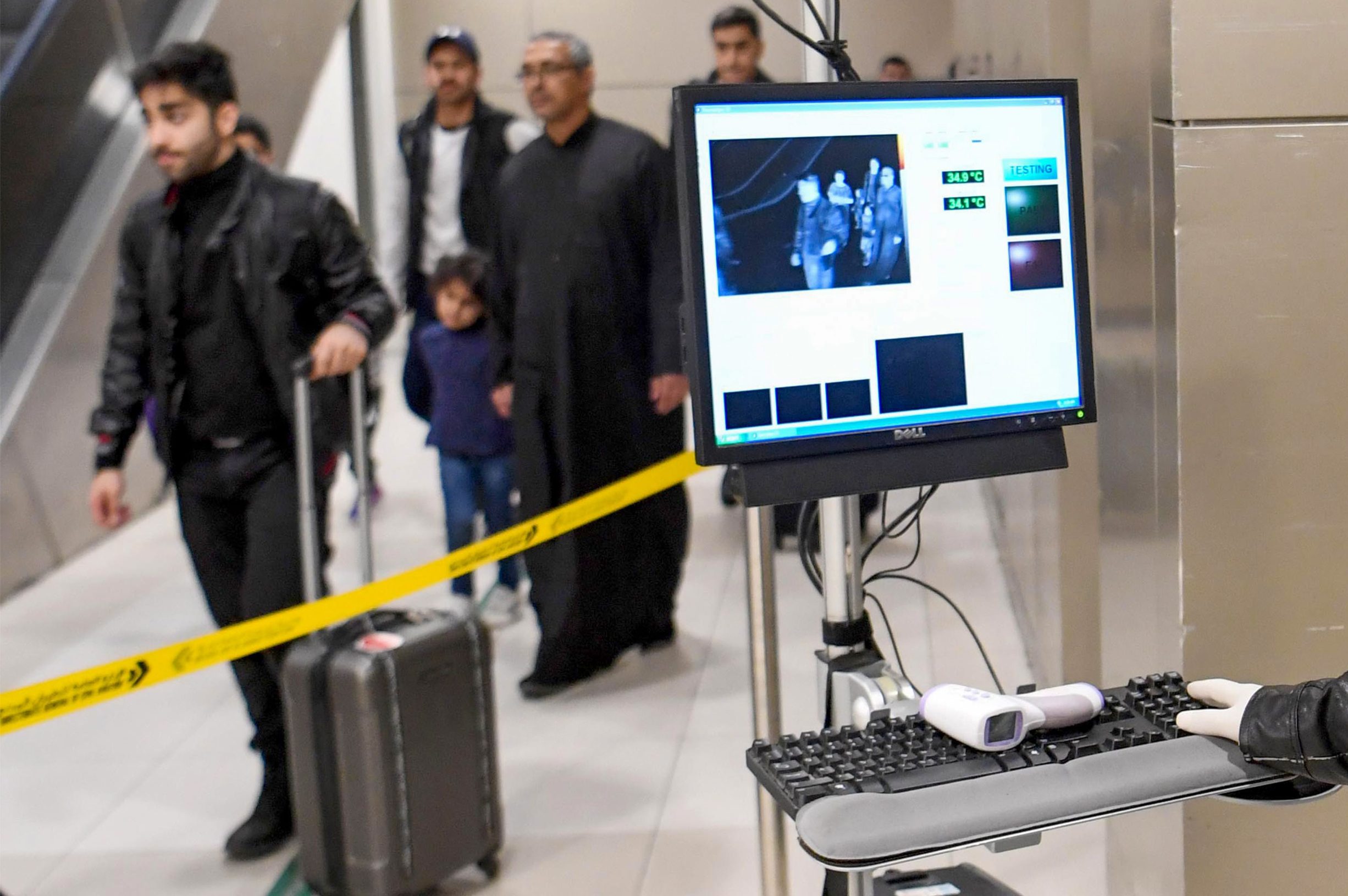 Temperature scanners are causing delays