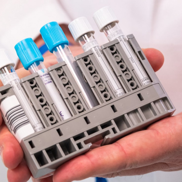 Serološki testovi Rochea