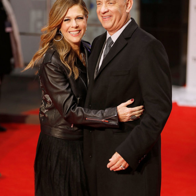 Ovaj par je toliko duboko povezan da više ne mogu zamisliti život jedan bez drugoga