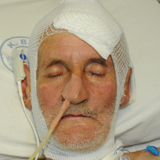 Nepoznati muškarac koji je u lipnju s ozljedom glave pronađen u mjestu Kalinovica