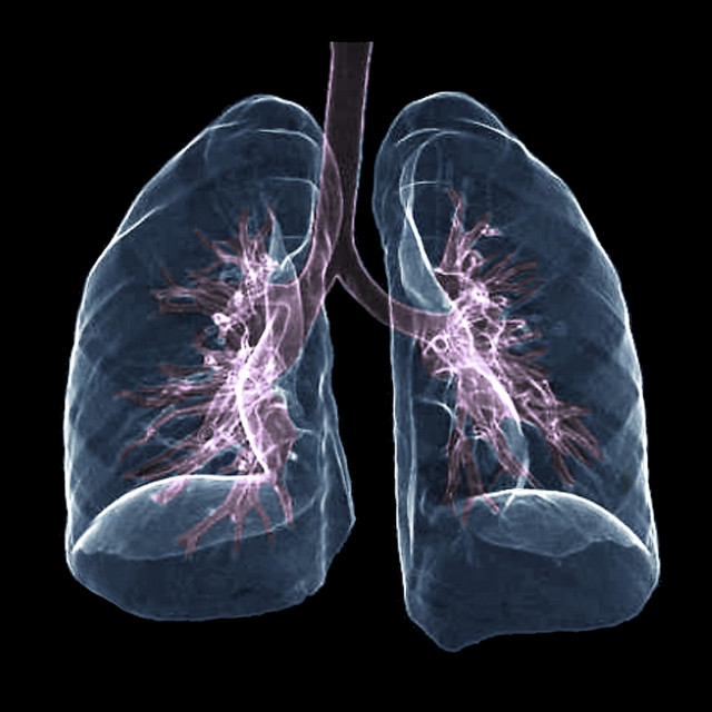 Zdrava pluća