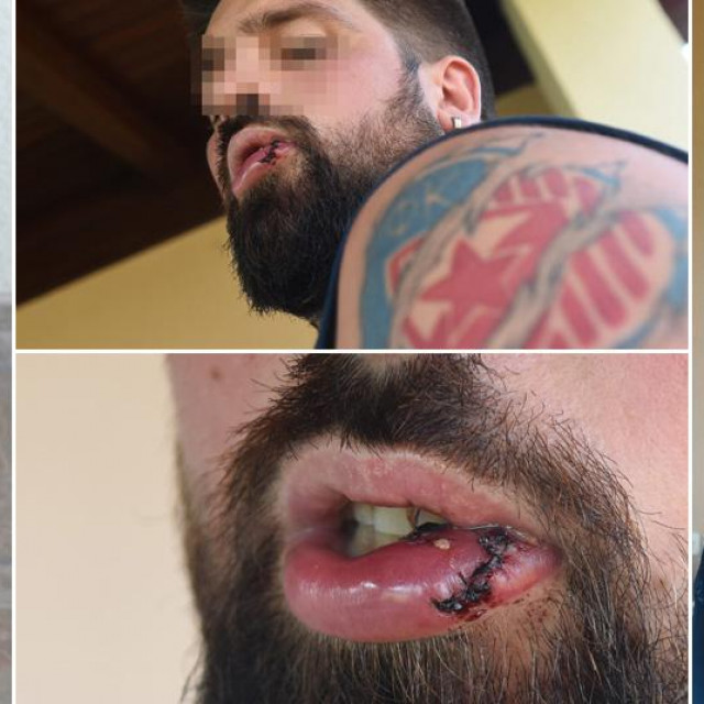 Srbin iz Austrije pretučen u Baškoj Vodi