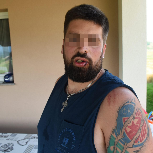 Srbin iz Austrije pretučen u Baškoj Vodi