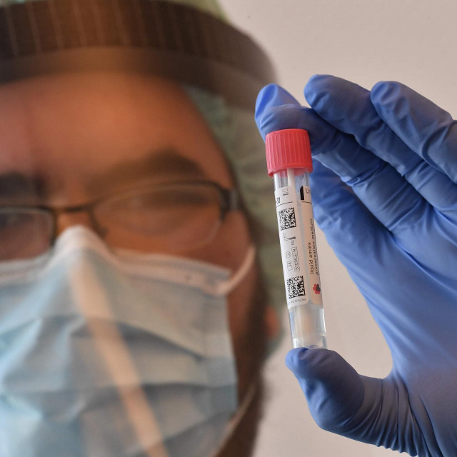 Testiranje na novi koronavirus