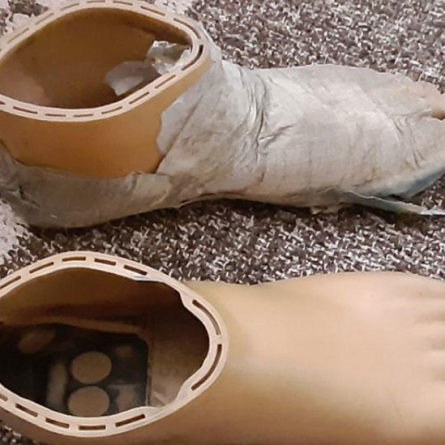 Proteza je stigla u paketu iz Hrvatske