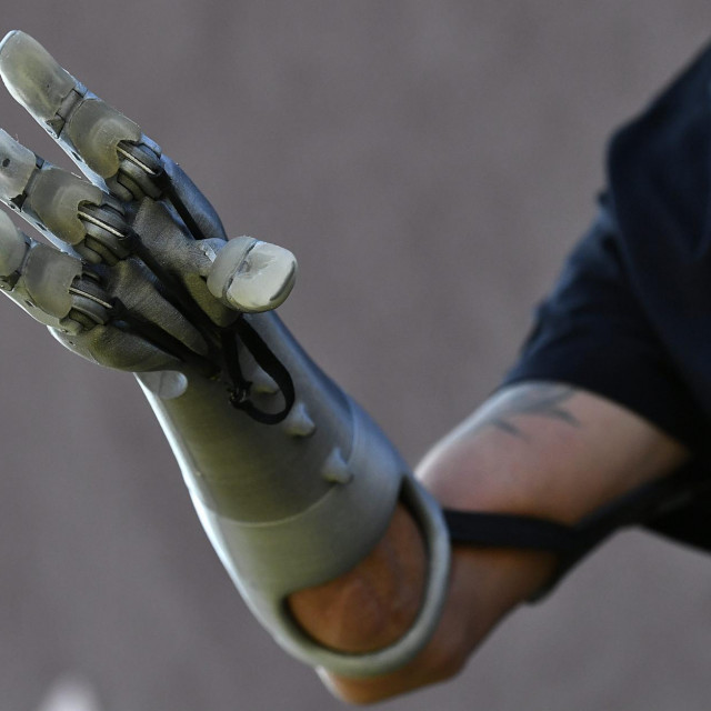 Krunoslav Mihić i njegova mehanička ruka