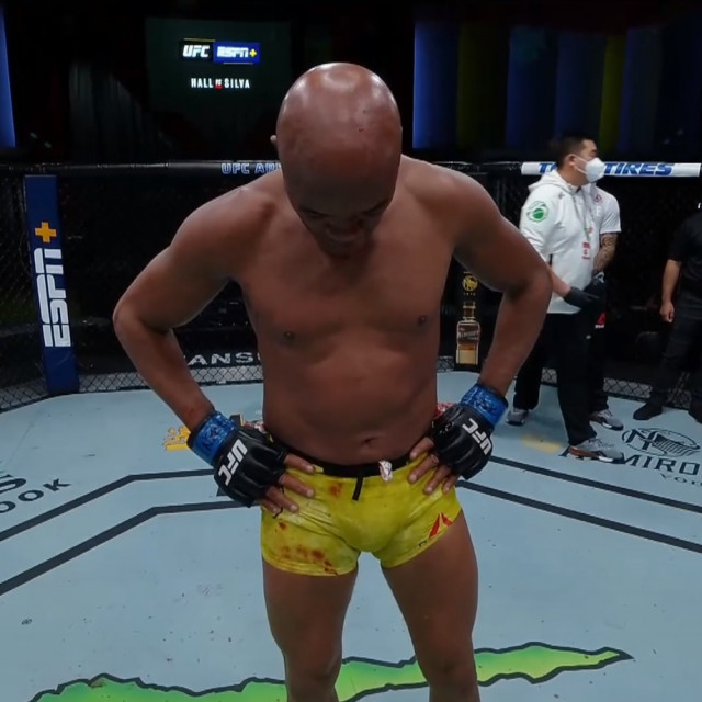 Anderson Silva