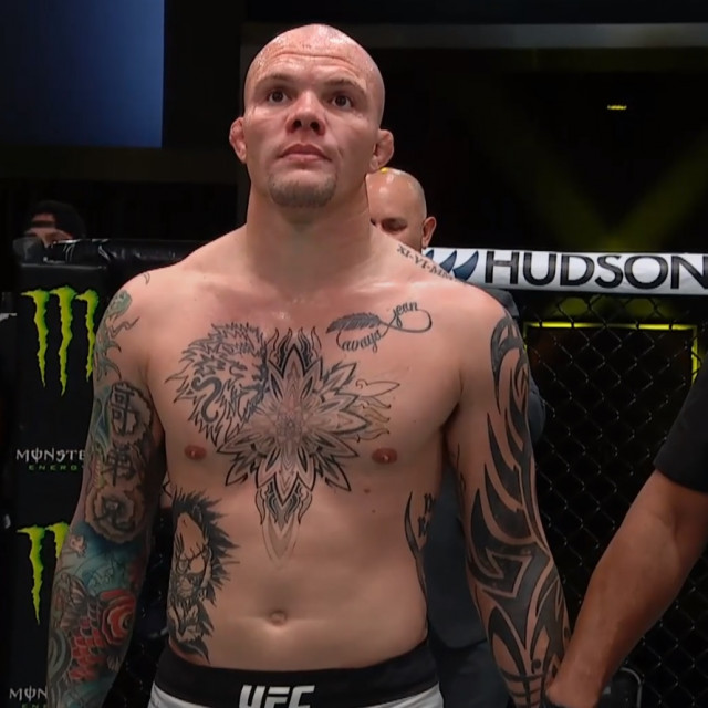 Anthony Smith