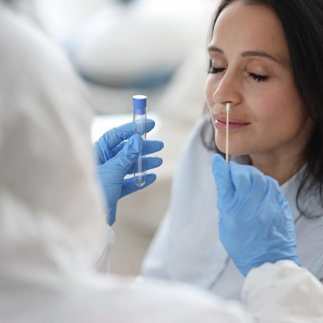 RT-PCR test