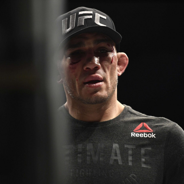 Tony Ferguson