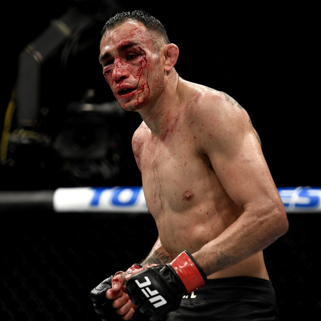 Tony Ferguson