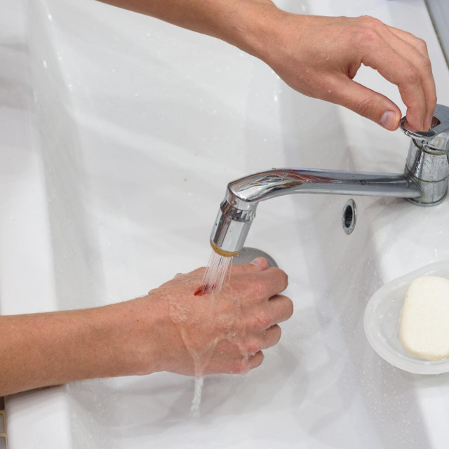 A man washes a wound on his hand under a stream of water in the washbasin