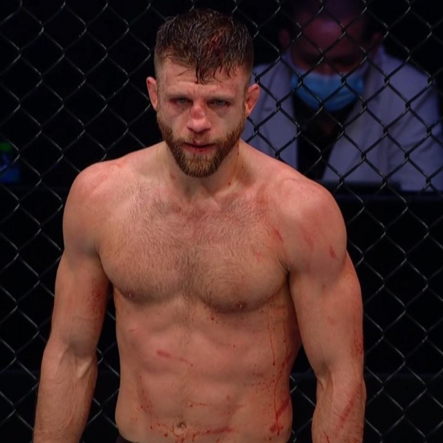 Calvin Kattar