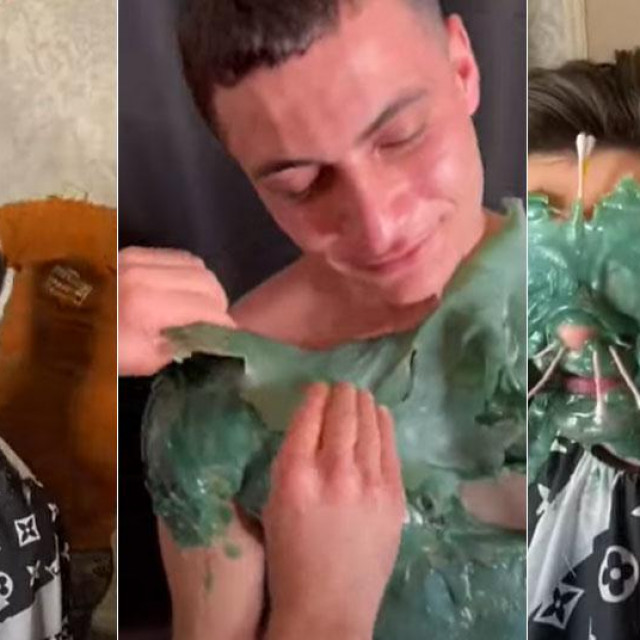 Kontroverzna depilacija lica