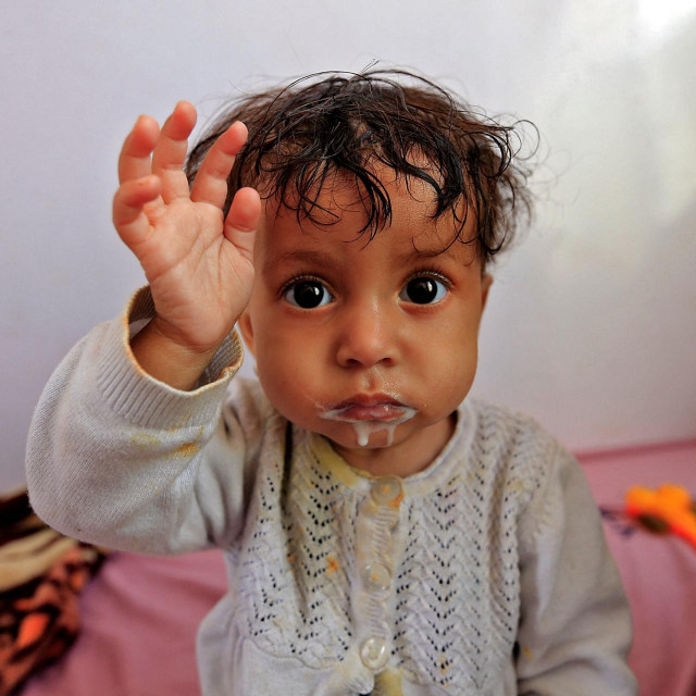 Dijete u Jemenu
