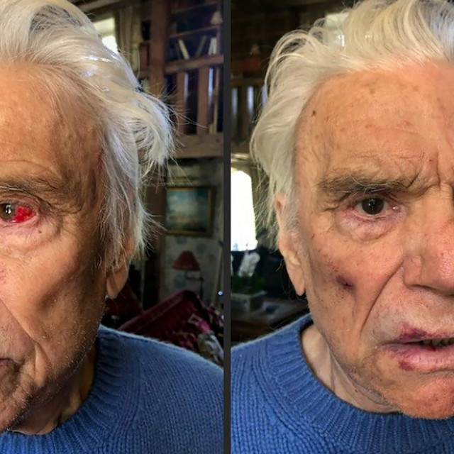 Pretučeni Bernard Tapie