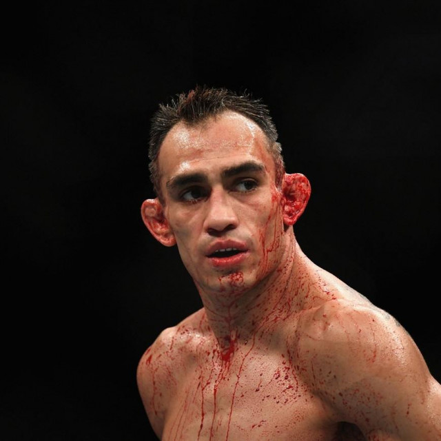 Tony Ferguson