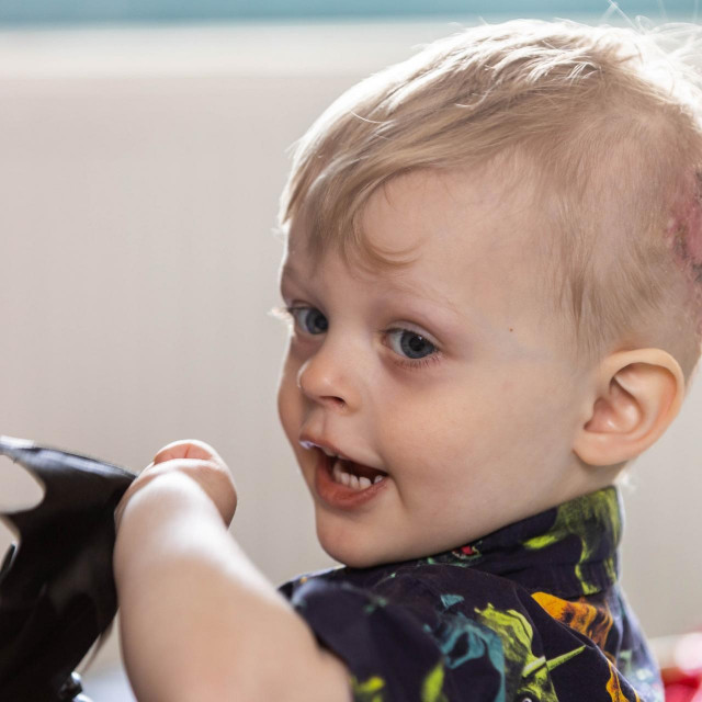 Dječak preživio težak ugriz psa