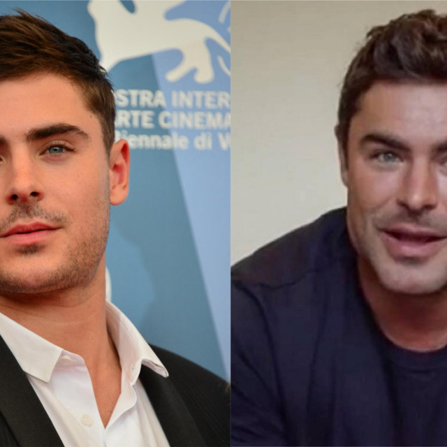 Zac Efron, prije i sada