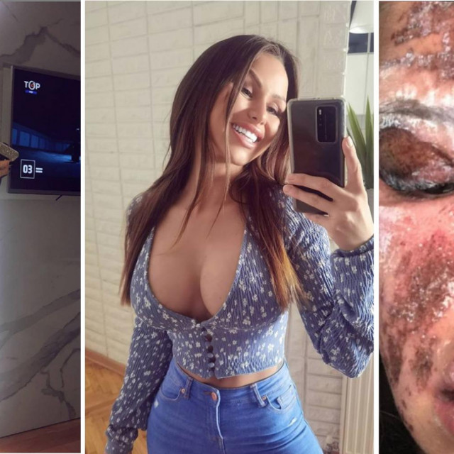 Željana Milanović (lijevo), slučaj s Instagram stranice za podršku žrtvama nadrilliječništva (desno)