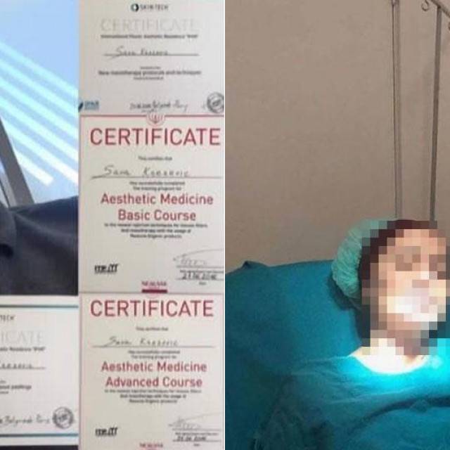 Sava Knežević, lažni estetski kirurg