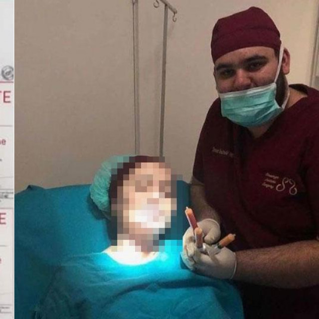 Sava Knežević, lažni estetski kirurg