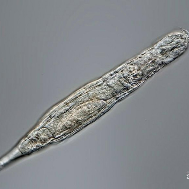 Bdelloidea Rotifer  