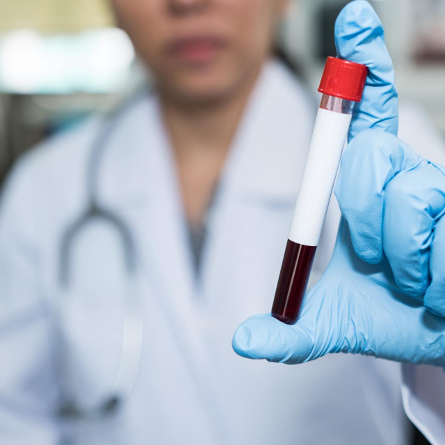 Većina ljudi koji imaju hepatitis C nema nikakve simptome