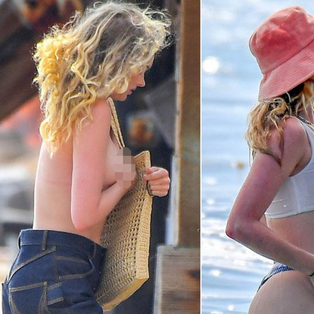 Elsa Hosk zaboravila majicu