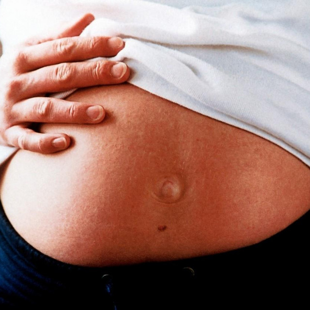 Trudnica, Ilustracija