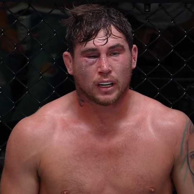Darren Till