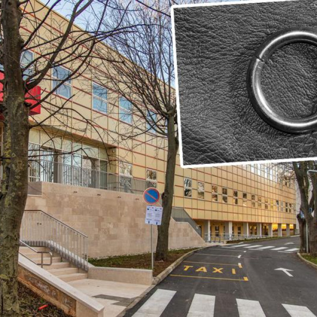 Opća bolnica u Puli; u pravokutniku: ilustracija prstena