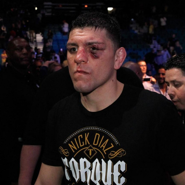 Nick Diaz