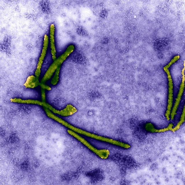 Ebola virus