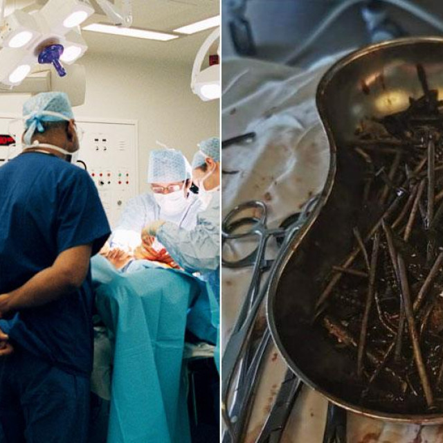 Metalni predmeti izvađeni iz pacijenta