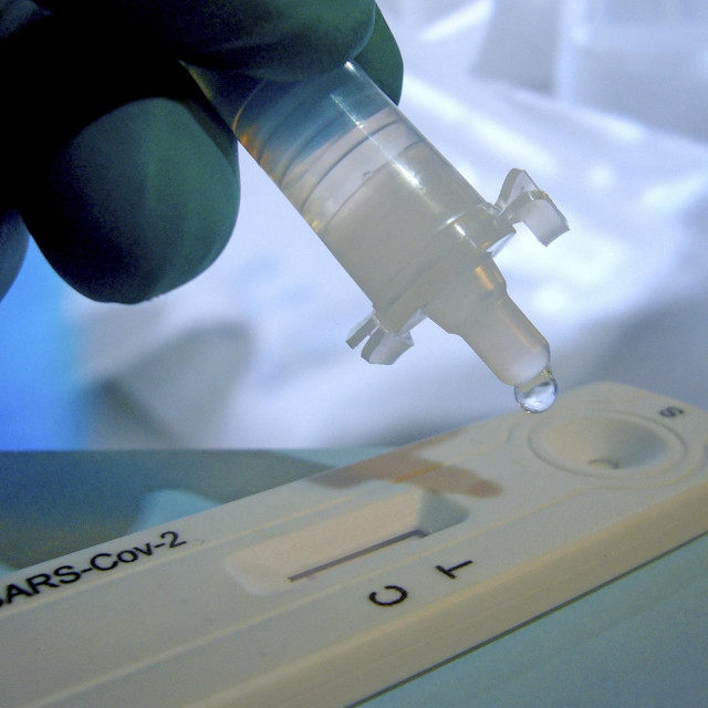 Test na koronavirus