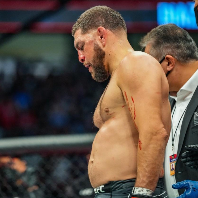Nick Diaz