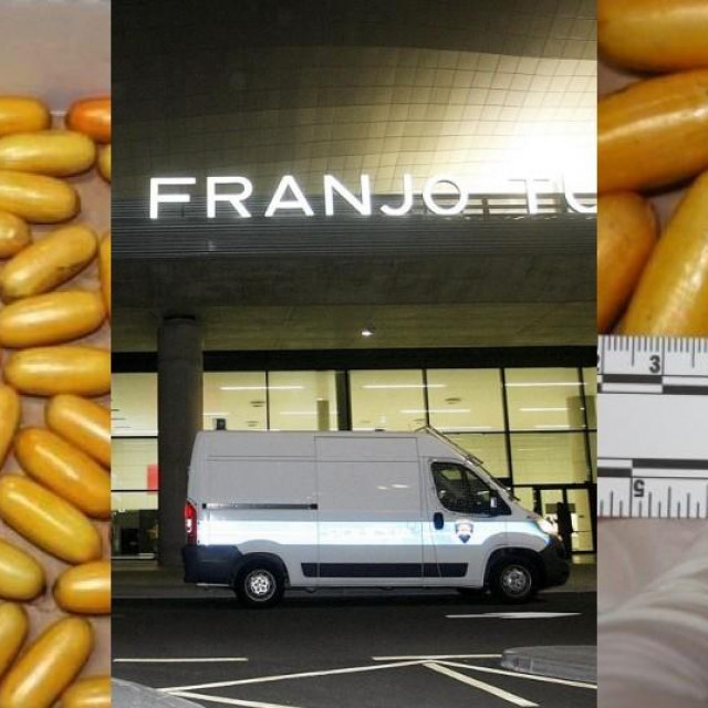 Brazilka progutala 76 kapsula